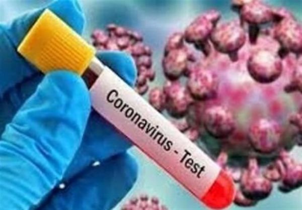 احتمال ابتلای همزمان به کووید ۱۹ و آنفلوانزا وجود دارد؟