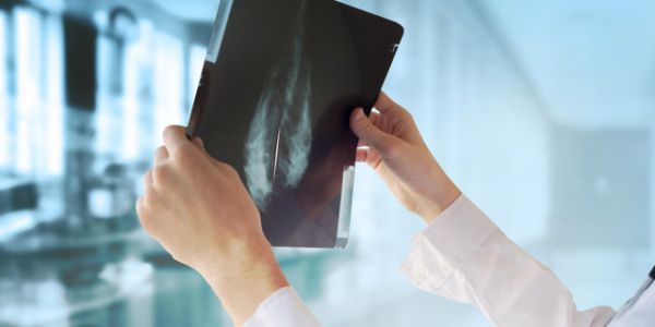 چرا برخی زنان 